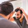 Dandruff Treatment
